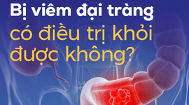 Bị viêm đại tràng có điều trị khỏi được không?