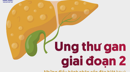 Ung thư gan giai đoạn 2: Những điều bệnh nhân cần đặc biệt lưu ý