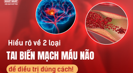 Hiểu rõ về 2 loại tai biến mạch máu não để điều trị đúng cách!