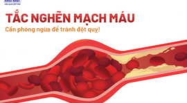 Tắc nghẽn mạch máu – Cần phòng ngừa để tránh đột quỵ!