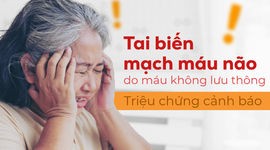 Tai biến mạch máu não do máu không lưu thông: Triệu chứng cảnh báo