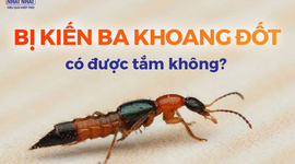 Tư vấn: Bị kiến ba khoang đốt có được tắm không? 