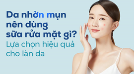 Da nhờn mụn nên dùng sữa rửa mặt gì? Lựa chọn hiệu quả cho làn da