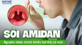 Sỏi amidan: Nguyên nhân chính khiến hơi thở có mùi mà nhiều người chưa biết