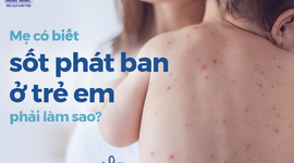 Mẹ có biết sốt phát ban ở trẻ em phải làm sao?