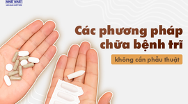 Các phương pháp chữa bệnh trĩ không cần phẫu thuật