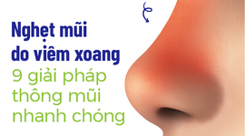 Nghẹt mũi do viêm xoang: 9 giải pháp thông mũi nhanh chóng