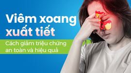 Viêm xoang xuất tiết: Cách giảm triệu chứng an toàn và hiệu quả