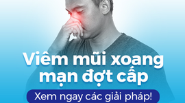 Viêm mũi xoang mạn đợt cấp: Xem ngay các giải pháp!