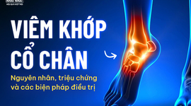 Viêm khớp cổ chân: Nguyên nhân, triệu chứng và các biện pháp điều trị