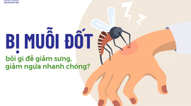 Con bị muỗi đốt bôi gì để giảm sưng, giảm ngứa nhanh chóng?