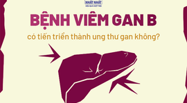 Giải đáp nhanh: Bệnh viêm gan B có tiến triển thành ung thư gan không?