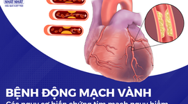 Bệnh động mạch vành và các nguy cơ biến chứng tim mạch nguy hiểm
