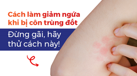 Cách làm giảm ngứa khi bị côn trùng đốt: Đừng gãi, hãy thử cách này!
