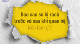 Bao cao su bị rách trước và sau khi quan hệ: Nên làm gì?