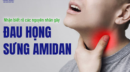 Nhận biết rõ các nguyên nhân gây đau họng sưng amidan