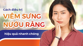 Cách điều trị viêm sưng nướu răng hiệu quả nhanh chóng