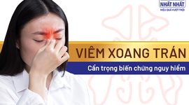 Viêm xoang trán: Cẩn trọng biến chứng nguy hiểm