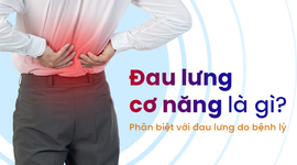 Đau lưng cơ năng là gì? Phân biệt với đau lưng do bệnh lý