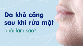 Da khô căng sau khi rửa mặt phải làm sao?