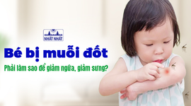 Bé bị muỗi đốt, phải làm sao để giảm ngứa, giảm sưng cho bé?