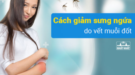 Tổng hợp các cách giảm sưng ngứa do vết muỗi đốt nhanh chóng và an toàn