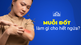 Muỗi đốt làm gì cho hết ngứa, bạn có biết không?
