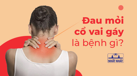 Đau mỏi cổ vai gáy là bệnh gì: Đáp án khiến nhiều người ngạc nhiên