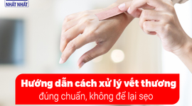 Hướng dẫn cách xử lý vết thương đúng chuẩn, không để lại sẹo