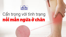 Cẩn trọng với tình trạng nổi mẩn ngứa ở chân