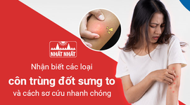 Nhận biết các loại côn trùng đốt sưng to và cách sơ cứu nhanh chóng