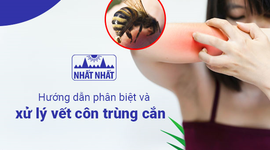 Hướng dẫn phân biệt và xử lý vết côn trùng cắn