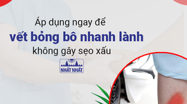 Áp dụng ngay để vết bỏng bô nhanh lành, không gây sẹo xấu
