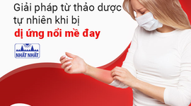 Giải pháp từ thảo dược tự nhiên khi bị dị ứng nổi mề đay