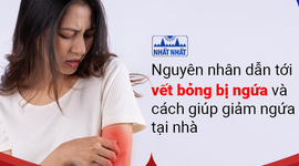 Nguyên nhân dẫn tới vết bỏng bị ngứa và cách giúp giảm ngứa tại nhà