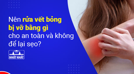 Nên rửa vết bỏng bị vỡ bằng gì cho an toàn và không để lại sẹo?