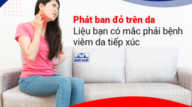 Phát ban đỏ trên da – Liệu bạn có mắc phải bệnh viêm da tiếp xúc?