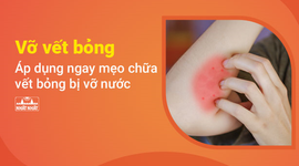 Vỡ vết bỏng - Áp dụng ngay mẹo chữa vết bỏng bị vỡ nước