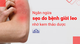 Ngăn ngừa sẹo do bệnh giời leo nhờ kem thảo dược