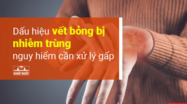 Dấu hiệu vết bỏng bị nhiễm trùng nguy hiểm cần xử lý gấp