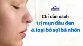 Chỉ dẫn cách trị mụn đầu đen và loại bỏ sợi bã nhờn