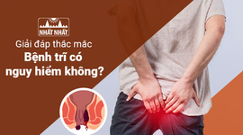 Giải đáp thắc mắc: “Bệnh trĩ có nguy hiểm không?” 