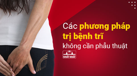 Các phương pháp trị bệnh trĩ không cần phẫu thuật