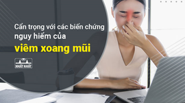 Cẩn trọng với các biến chứng nguy hiểm của viêm xoang mũi