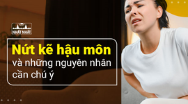 Nứt kẽ hậu môn nguyên nhân và những giải pháp cần chú ý