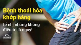 Bệnh thoái hóa khớp háng: tế nhị nhưng không điều trị là nguy!