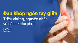 Đau khớp ngón tay giữa: Triệu chứng, nguyên nhân và cách khắc phục