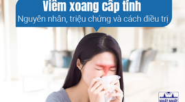 Viêm xoang cấp tính - Nguyên nhân, triệu chứng và cách điều trị