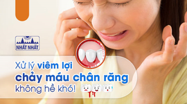 Xử lý viêm lợi chảy máu chân răng không hề khó!