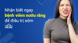 Nhận biết ngay bệnh viêm nướu răng để điều trị sớm